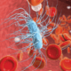 Magnified graphic of sepsis and red blood cells.