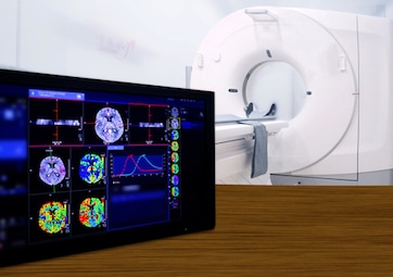 The Importance of CT Scans in Traumatic Brain Injuries